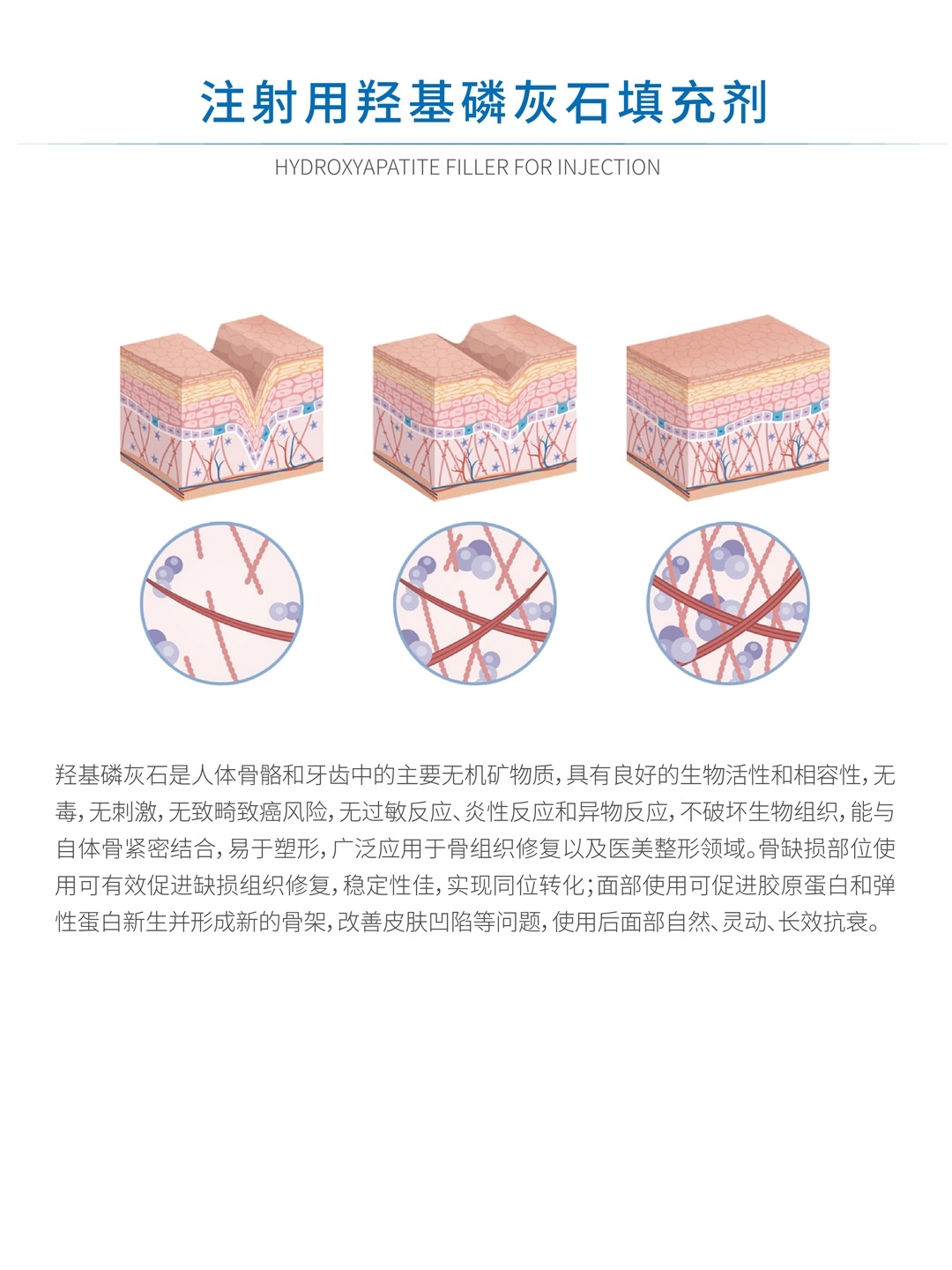 注射用羟基磷灰石填充剂2.jpg